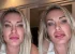 VÍDEO: Andressa Urach revela coceira em parte íntima após uso de medicamento contra doença sem cura: “Achei estranho”