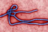 Exames descartam ebola em um dos casos suspeitos no Brasil