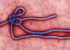 Exames descartam ebola em um dos casos suspeitos no Brasil