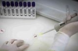 Estado de São Paulo descarta segundo caso suspeito de ebola registrado em 2026
