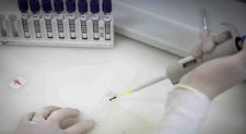 Estado de São Paulo descarta segundo caso suspeito de ebola registrado em 2026