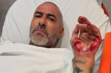 Henrique Fogaça detalha acidente e denuncia roubo de aliança em hospital após acidente
