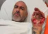 Henrique Fogaça detalha acidente e denuncia roubo de aliança em hospital após acidente